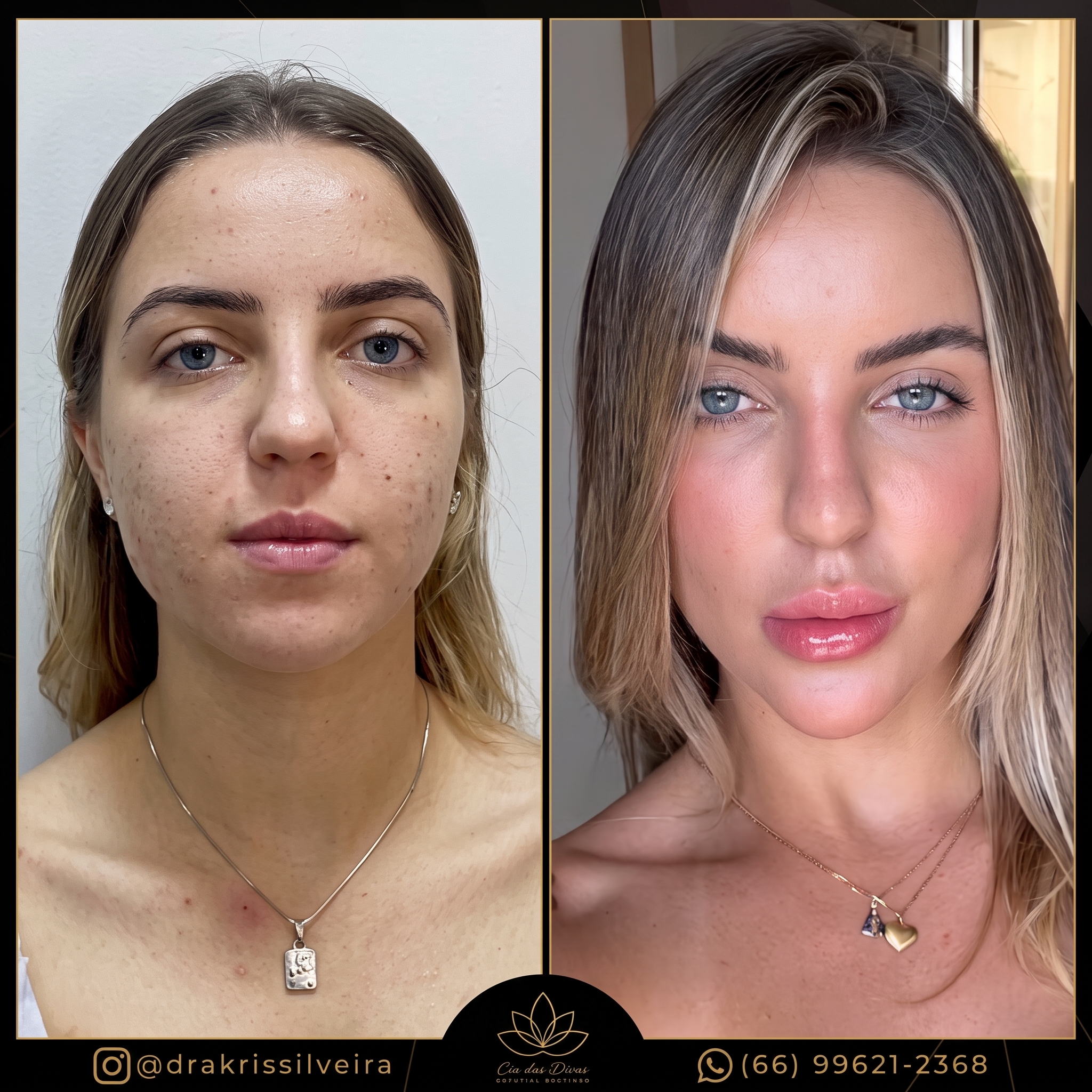 Resultado Cliente 1